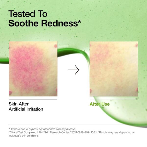 Anua, Azelaic Acid 10 Hyaluron Redness Soothing Serum, აზელაინის მჟავის შრატი, 30 ML - Image 3