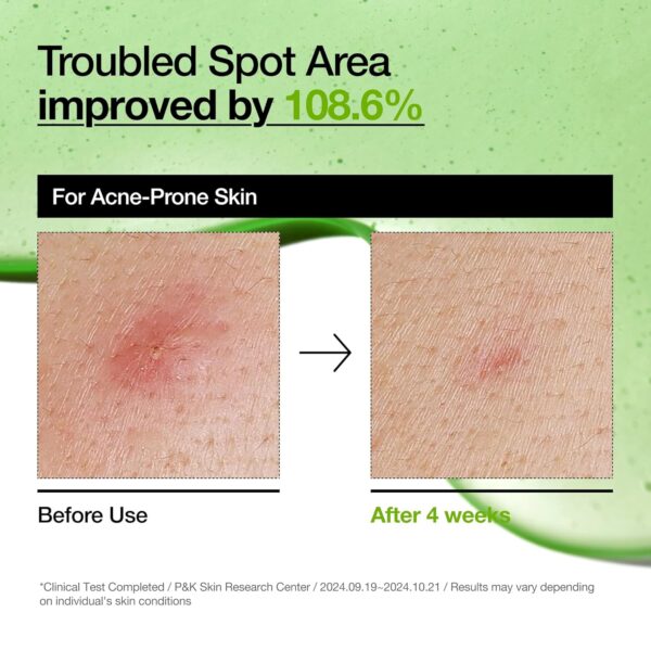 Anua, Azelaic Acid 10 Hyaluron Redness Soothing Serum, აზელაინის მჟავის შრატი, 30 ML - Image 5