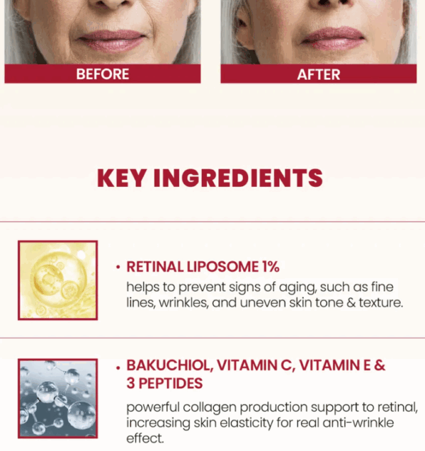 KSECRET, SEOUL 1988 Cream : Retinal Liposome 1% + Fermented Rice, რეტინალის კრემი, 50 ML - Image 4