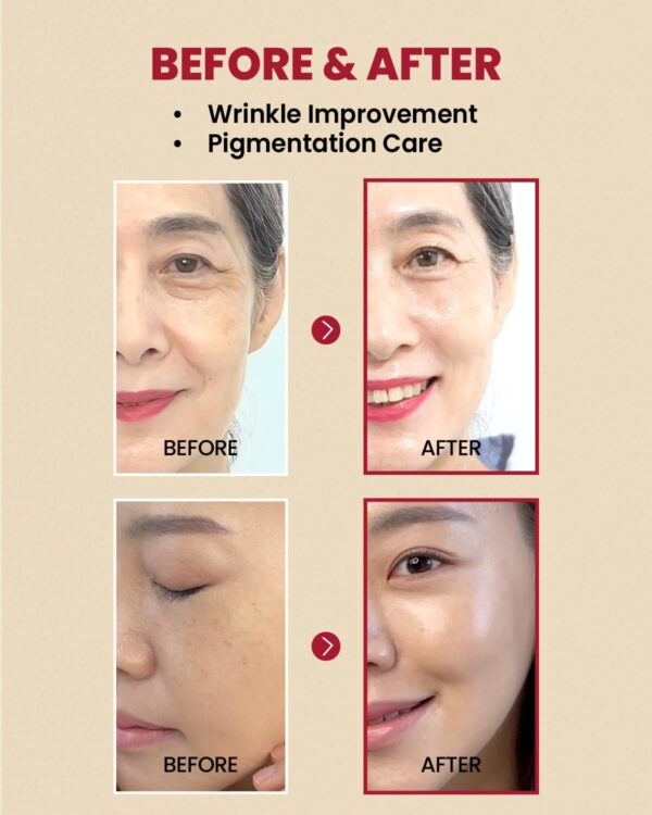 KSECRET, SEOUL 1988 Serum : Retinal Liposome 2% + Black Ginseng, რეტინალის შრატი, 30 ML - Image 3