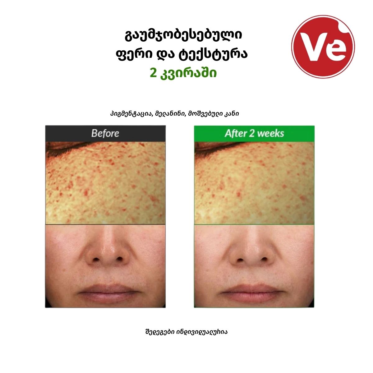 Dr. Althea, Gentle Vitamin C Serum, მსუბუქი C ვიტამინის შრატი, 30 მლ - Image 4