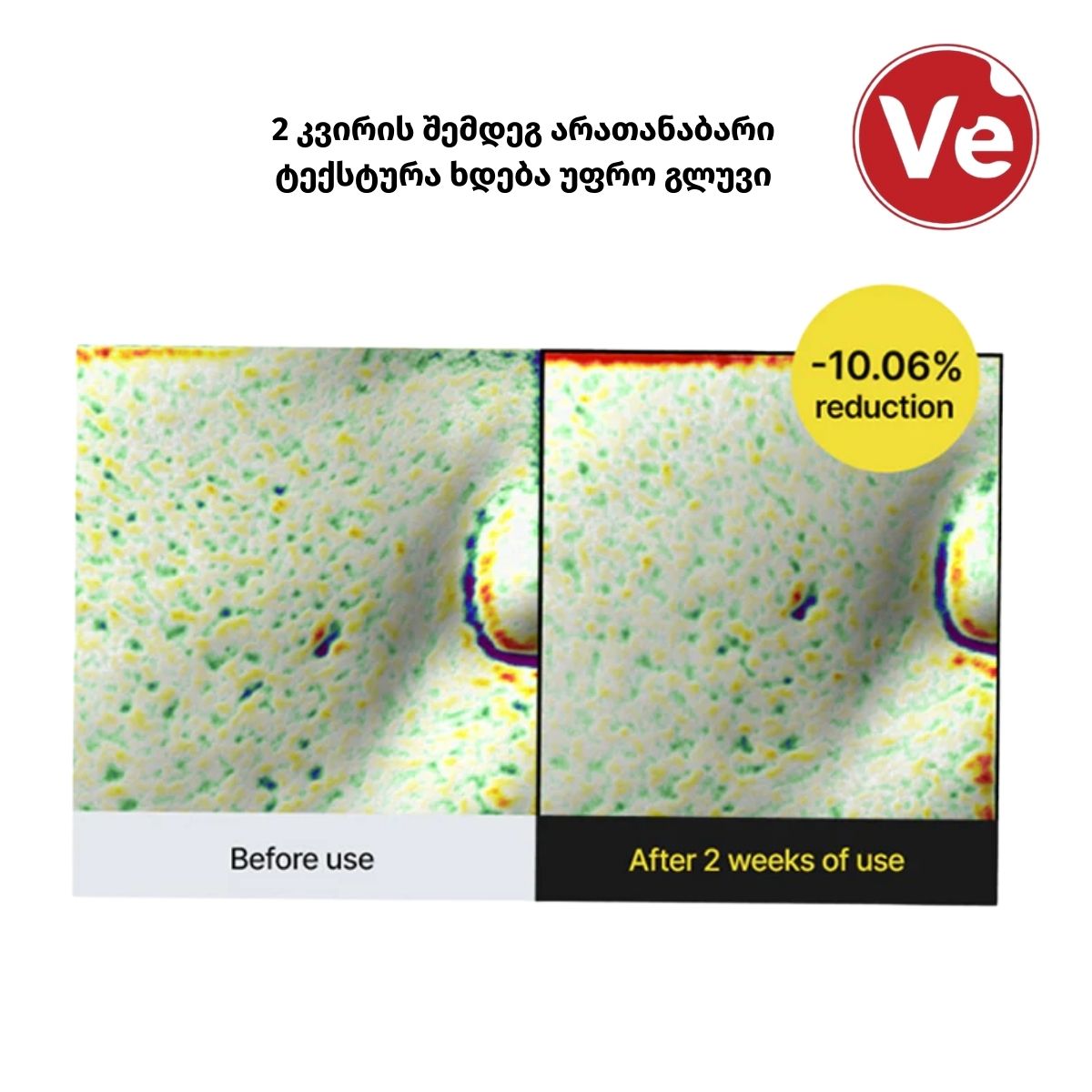 Celimax, Vita-A Retinol Shot Tightening Serum, რეტინოლის გამამკვრივებელი შრატი, 30 მლ - Image 5