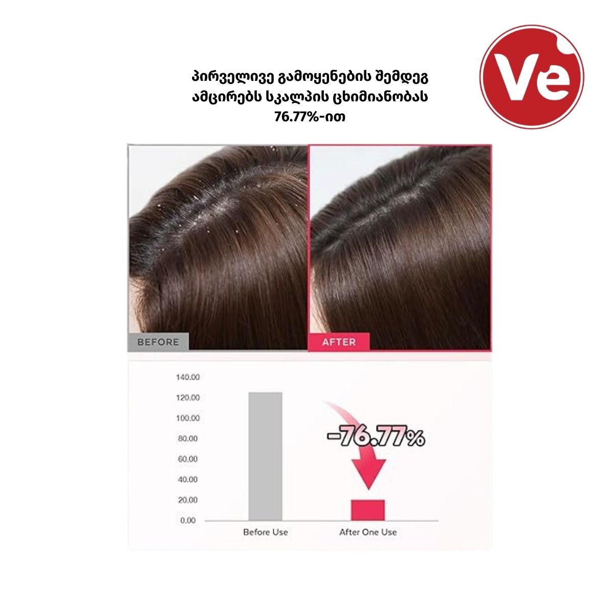 A’pieu, Raspberry Hair Vinegar, ჟოლოს ძმარი თმის ბზინვარებისთვის, 200 გ - Image 4